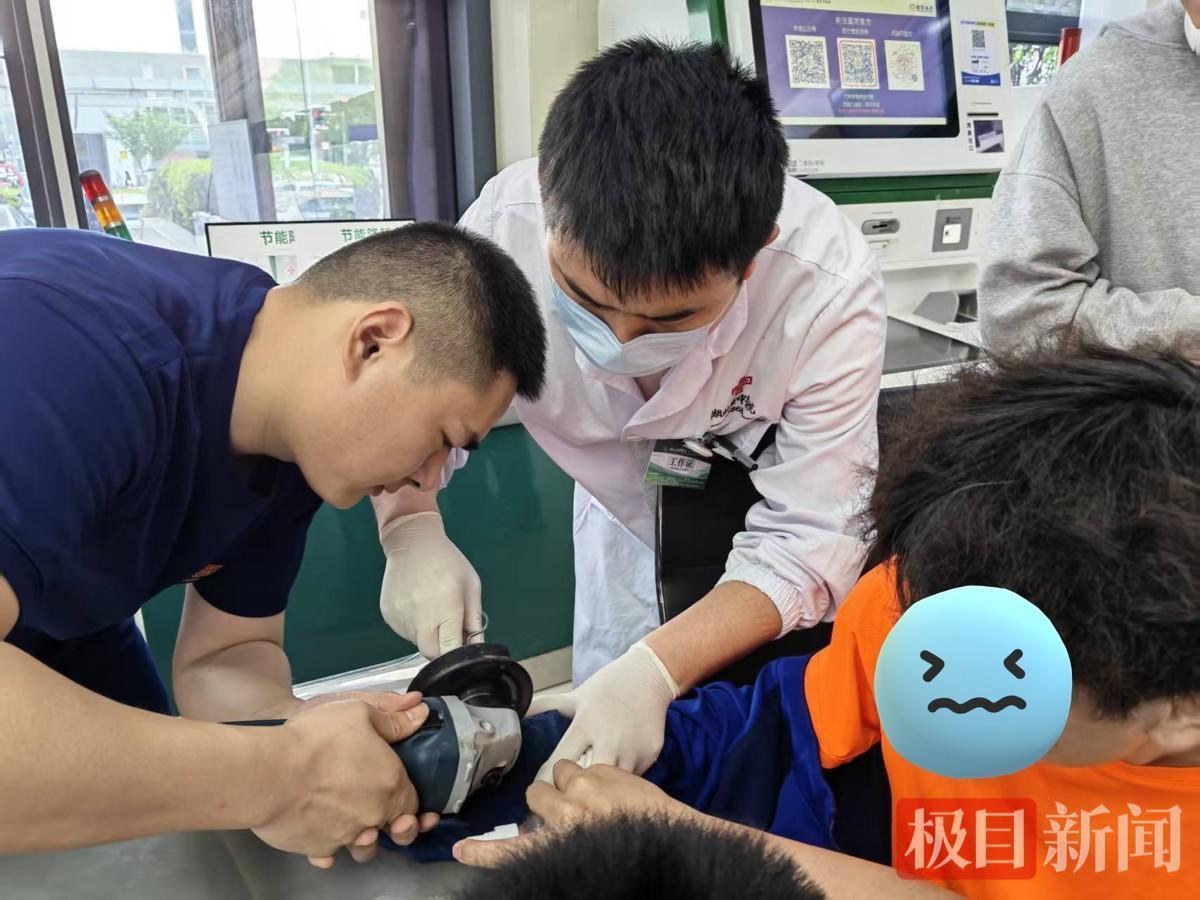  戒指嵌顿危机：消防与医学联动救援的技术复盘与肢体急救指南 健康养生